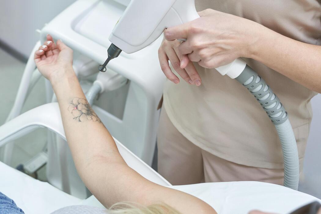 Ile sesji potrzeba, żeby usunąć tatuaż całkowicie?